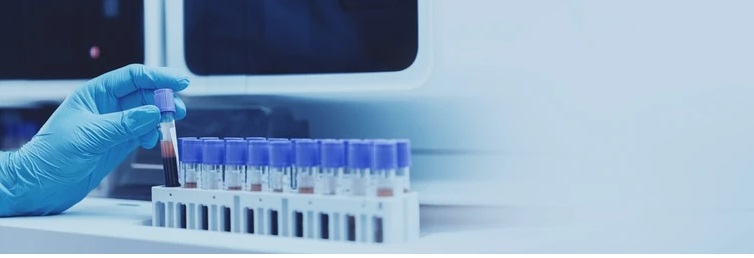 Laboratory Diagnostic Equipment